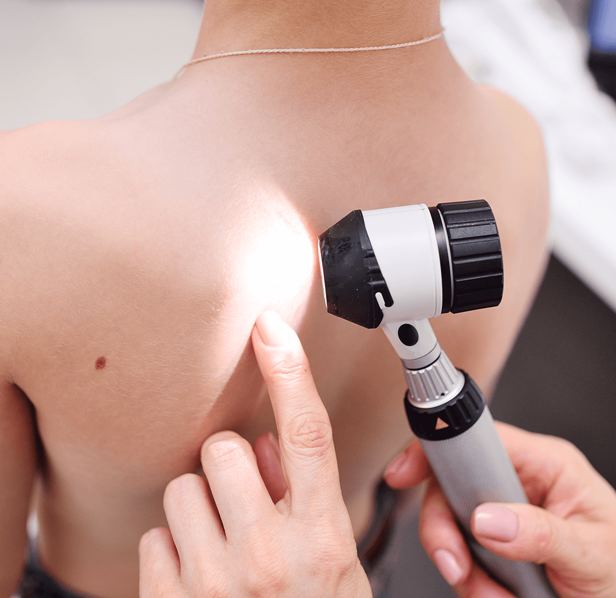 Μολυσματική Τέρμινθος